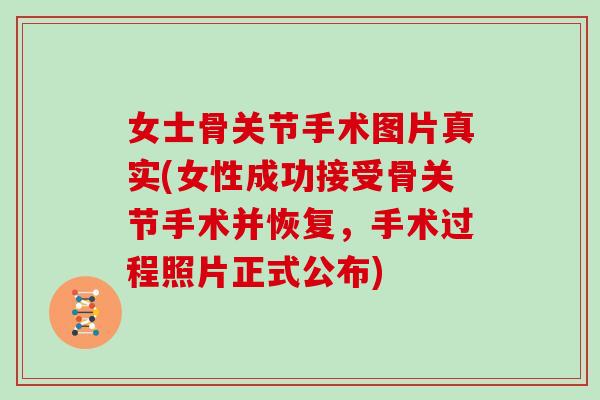 女士骨关节手术图片真实(女性成功接受骨关节手术并恢复，手术过程照片正式公布)