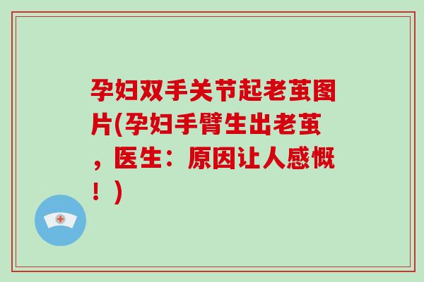 孕妇双手关节起老茧图片(孕妇手臂生出老茧,医生:原因让人感慨!) 孕妇双手关节起老茧图片(孕妇手臂生出老茧,医生:原因让人感慨!)