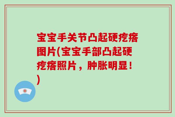 宝宝手关节凸起硬疙瘩图片(宝宝手部凸起硬疙瘩照片，明显！)