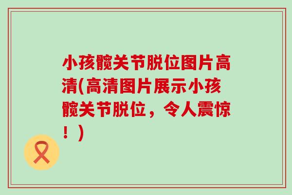 小孩髋关节脱位图片高清(高清图片展示小孩髋关节脱位,令人震惊!) 小孩髋关节脱位图片高清(高清图片展示小孩髋关节脱位,令人震惊!)