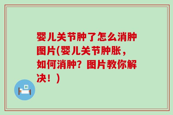婴儿关节肿了怎么消肿图片(婴儿关节,如何消肿?图片教你解决!) 婴儿关节肿了怎么消肿图片(婴儿关节,如何消肿?图片教你解决!)