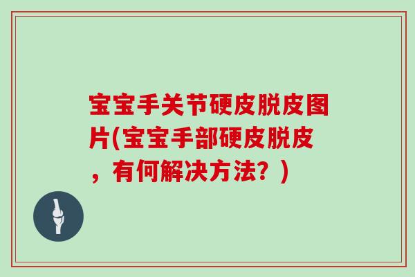 宝宝手关节硬皮脱皮图片(宝宝手部硬皮脱皮，有何解决方法？)