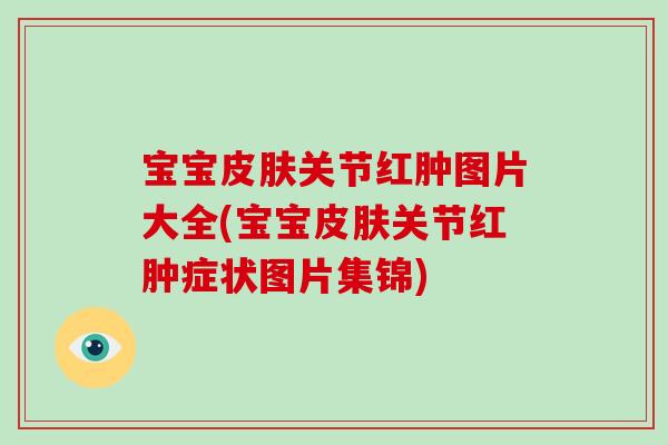 宝宝关节红肿图片大全(宝宝关节红肿症状图片集锦)