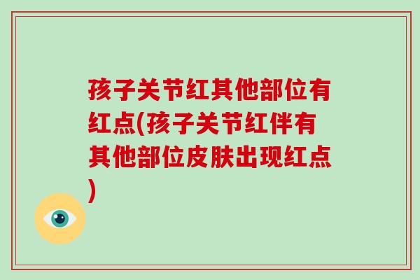孩子关节红其他部位有红点(孩子关节红伴有其他部位出现红点) 孩子关节红其他部位有红点(孩子关节红伴有其他部位出现红点)