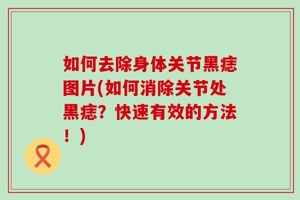 如何去除身体关节黑痣图片(如何消除关节处黑痣?快速有效的方法!) 如何去除身体关节黑痣图片(如何消除关节处黑痣?快速有效的方法!)