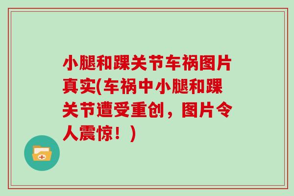 小腿和踝关节车祸图片真实(车祸中小腿和踝关节遭受重创,图片令人震惊!) 小腿和踝关节车祸图片真实(车祸中小腿和踝关节遭受重创,图片令人震惊!)