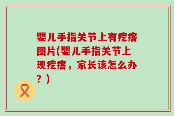 婴儿手指关节上有疙瘩图片(婴儿手指关节上现疙瘩,家长该怎么办?) 婴儿手指关节上有疙瘩图片(婴儿手指关节上现疙瘩,家长该怎么办?)