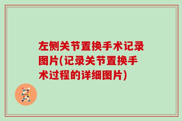左侧关节置换手术记录图片(记录关节置换手术过程的详细图片)