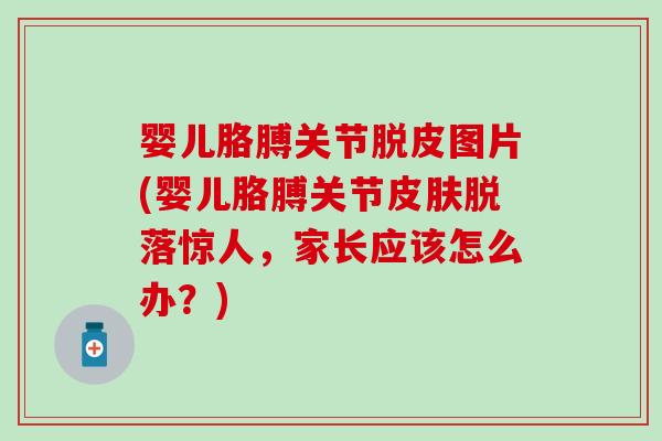婴儿胳膊关节脱皮图片(婴儿胳膊关节脱落惊人,家长应该怎么办?) 婴儿胳膊关节脱皮图片(婴儿胳膊关节脱落惊人,家长应该怎么办?)