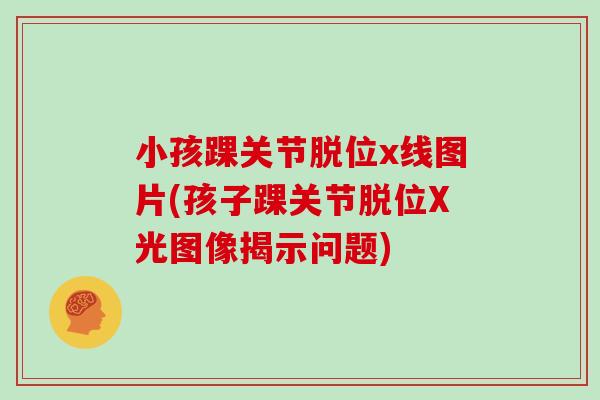 小孩踝关节脱位x线图片(孩子踝关节脱位X光图像揭示问题) 小孩踝关节脱位x线图片(孩子踝关节脱位X光图像揭示问题)