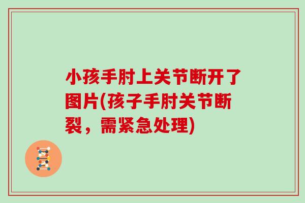 小孩手肘上关节断开了图片(孩子手肘关节断裂,需紧急处理) 小孩手肘上关节断开了图片(孩子手肘关节断裂,需紧急处理)