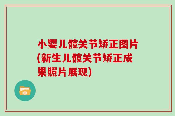 小婴儿髋关节矫正图片(新生儿髋关节矫正成果照片展现) 小婴儿髋关节矫正图片(新生儿髋关节矫正成果照片展现)