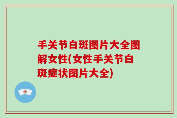 手关节白斑图片大全图解女性(女性手关节白斑症状图片大全) 手关节白斑图片大全图解女性(女性手关节白斑症状图片大全)