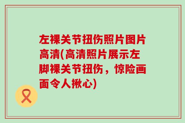 左裸关节扭伤照片图片高清(高清照片展示左脚裸关节扭伤,惊险画面令人揪心) 左裸关节扭伤照片图片高清(高清照片展示左脚裸关节扭伤,惊险画面令人揪心)