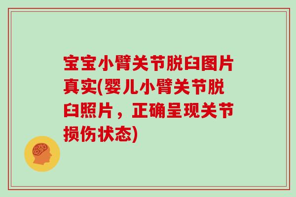 宝宝小臂关节脱臼图片真实(婴儿小臂关节脱臼照片,正确呈现关节损伤状态) 宝宝小臂关节脱臼图片真实(婴儿小臂关节脱臼照片,正确呈现关节损伤状态)