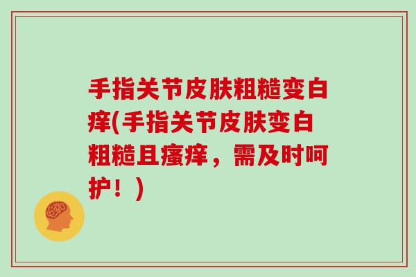 手指关节粗糙变白痒(手指关节变白粗糙且,需及时呵护!) 手指关节粗糙变白痒(手指关节变白粗糙且,需及时呵护!)