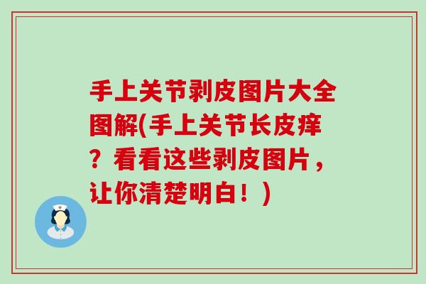 手上关节剥皮图片大全图解(手上关节长皮痒?看看这些剥皮图片,让你清楚明白!) 手上关节剥皮图片大全图解(手上关节长皮痒?看看这些剥皮图片,让你清楚明白!)