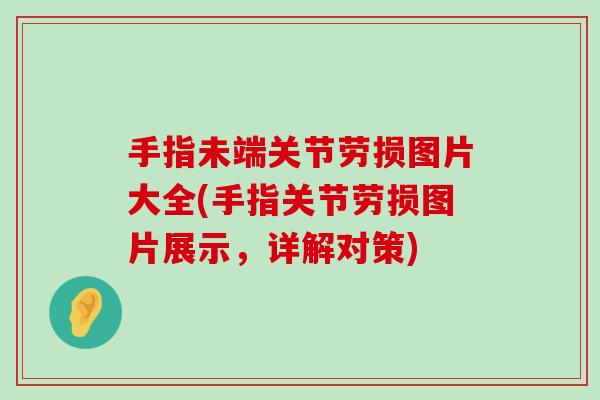 手指未端关节劳损图片大全(手指关节劳损图片展示,详解对策) 手指未端关节劳损图片大全(手指关节劳损图片展示,详解对策)
