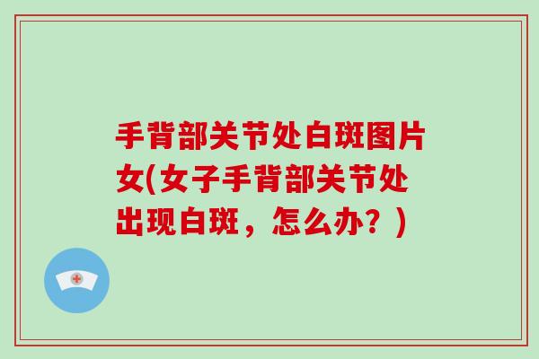 手背部关节处白斑图片女(女子手背部关节处出现白斑,怎么办?) 手背部关节处白斑图片女(女子手背部关节处出现白斑,怎么办?)