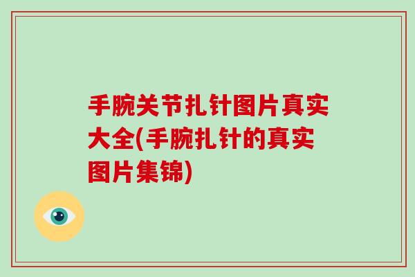 手腕关节扎针图片真实大全(手腕扎针的真实图片集锦) 手腕关节扎针图片真实大全(手腕扎针的真实图片集锦)