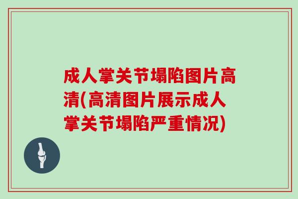 成人掌关节塌陷图片高清(高清图片展示成人掌关节塌陷严重情况)