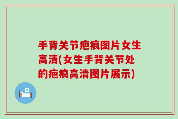 手背关节疤痕图片女生高清(女生手背关节处的疤痕高清图片展示) 手背关节疤痕图片女生高清(女生手背关节处的疤痕高清图片展示)