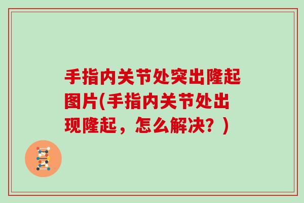 手指内关节处突出隆起图片(手指内关节处出现隆起,怎么解决?) 手指内关节处突出隆起图片(手指内关节处出现隆起,怎么解决?)