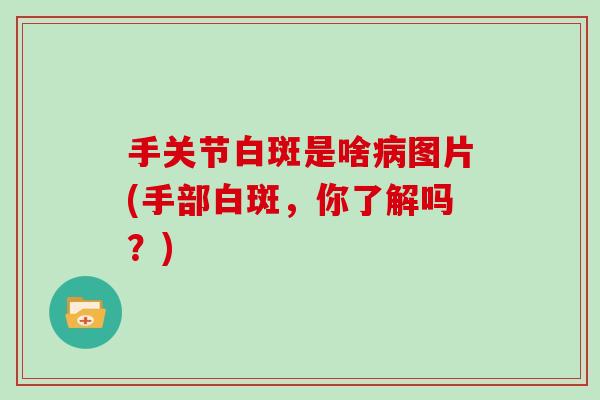 手关节白斑是啥图片(手部白斑，你了解吗？)