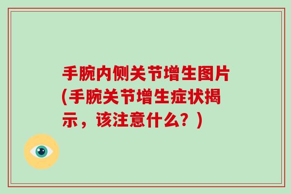 手腕内侧关节增生图片(手腕关节增生症状揭示，该注意什么？)