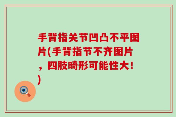 手背指关节凹凸不平图片(手背指节不齐图片,四肢畸形可能性大!) 手背指关节凹凸不平图片(手背指节不齐图片,四肢畸形可能性大!)