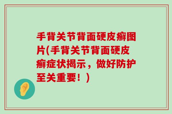 手背关节背面硬皮癣图片(手背关节背面硬皮癣症状揭示，做好防护至关重要！)