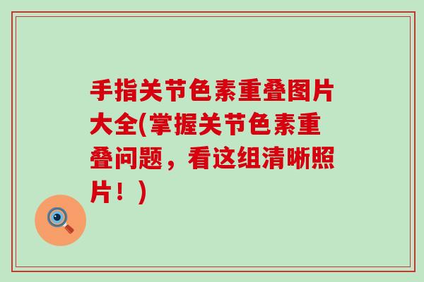 手指关节色素重叠图片大全(掌握关节色素重叠问题,看这组清晰照片!) 手指关节色素重叠图片大全(掌握关节色素重叠问题,看这组清晰照片!)