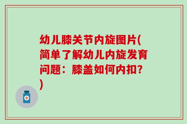 幼儿膝关节内旋图片(简单了解幼儿内旋发育问题:膝盖如何内扣?) 幼儿膝关节内旋图片(简单了解幼儿内旋发育问题:膝盖如何内扣?)