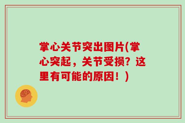 掌心关节突出图片(掌心突起,关节受损?这里有可能的原因!) 掌心关节突出图片(掌心突起,关节受损?这里有可能的原因!)