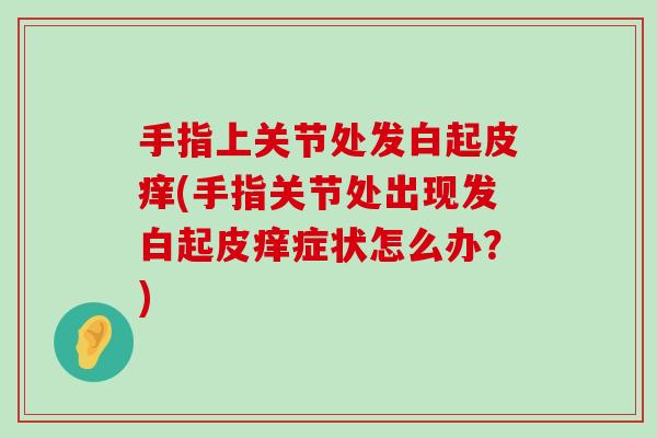 手指上关节处发白起皮痒(手指关节处出现发白起皮痒症状怎么办?) 手指上关节处发白起皮痒(手指关节处出现发白起皮痒症状怎么办?)