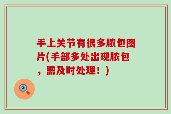 手上关节有很多脓包图片(手部多处出现脓包,需及时处理!) 手上关节有很多脓包图片(手部多处出现脓包,需及时处理!)