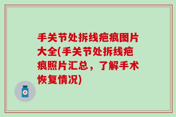 手关节处拆线疤痕图片大全(手关节处拆线疤痕照片汇总,了解手术恢复情况) 手关节处拆线疤痕图片大全(手关节处拆线疤痕照片汇总,了解手术恢复情况)