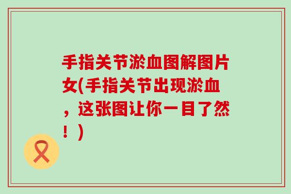 手指关节淤图解图片女(手指关节出现淤,这张图让你一目了然!) 手指关节淤图解图片女(手指关节出现淤,这张图让你一目了然!)