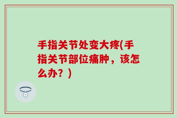 手指关节处变大疼(手指关节部位痛肿,该怎么办?) 手指关节处变大疼(手指关节部位痛肿,该怎么办?)