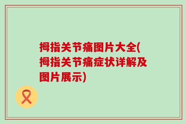 拇指关节痛图片大全(拇指关节痛症状详解及图片展示) 拇指关节痛图片大全(拇指关节痛症状详解及图片展示)