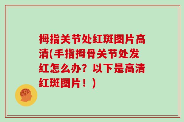 拇指关节处红斑图片高清(手指拇骨关节处发红怎么办?以下是高清红斑图片!) 拇指关节处红斑图片高清(手指拇骨关节处发红怎么办?以下是高清红斑图片!)