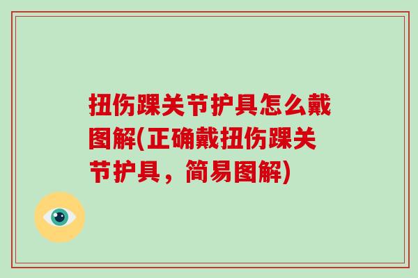 扭伤踝关节护具怎么戴图解(正确戴扭伤踝关节护具,简易图解) 扭伤踝关节护具怎么戴图解(正确戴扭伤踝关节护具,简易图解)