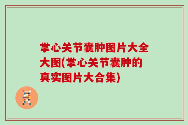 掌心关节囊肿图片大全大图(掌心关节囊肿的真实图片大合集)