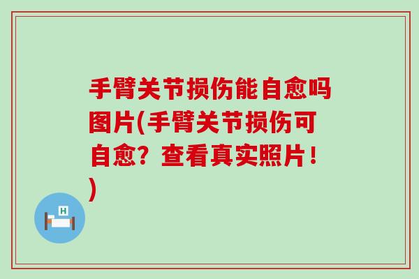 手臂关节损伤能自愈吗图片(手臂关节损伤可自愈?查看真实照片!) 手臂关节损伤能自愈吗图片(手臂关节损伤可自愈?查看真实照片!)