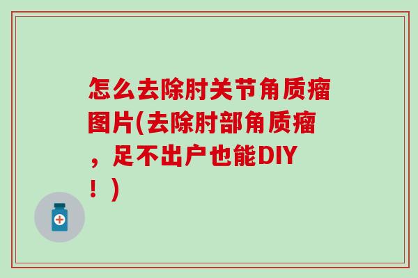 怎么去除肘关节角质瘤图片(去除肘部角质瘤,足不出户也能DIY!) 怎么去除肘关节角质瘤图片(去除肘部角质瘤,足不出户也能DIY!)