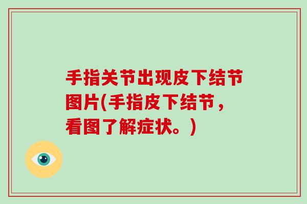 手指关节出现皮下结节图片(手指皮下结节,看图了解症状。) 手指关节出现皮下结节图片(手指皮下结节,看图了解症状。)