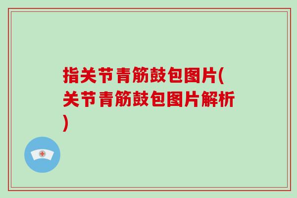 指关节青筋鼓包图片(关节青筋鼓包图片解析)