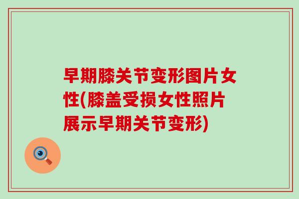 早期膝关节变形图片女性(膝盖受损女性照片展示早期关节变形)