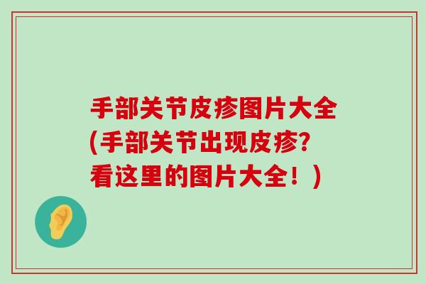手部关节皮疹图片大全(手部关节出现皮疹?看这里的图片大全!) 手部关节皮疹图片大全(手部关节出现皮疹?看这里的图片大全!)