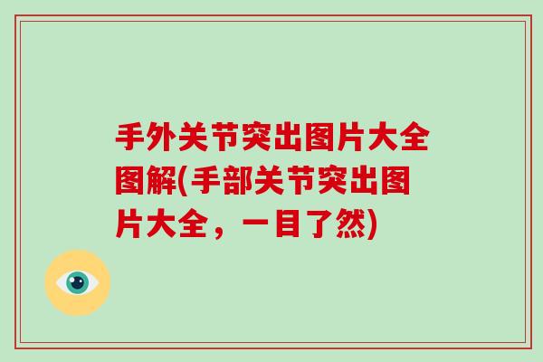 手外关节突出图片大全图解(手部关节突出图片大全,一目了然) 手外关节突出图片大全图解(手部关节突出图片大全,一目了然)